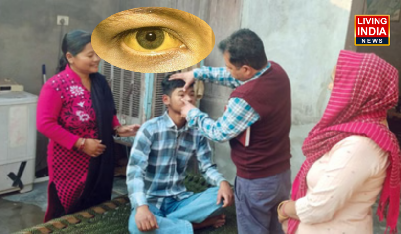 Ambala Jaundice: अंबाला के गांव में फैला पीलिया, स्वास्थ्य विभाग अलर्ट, गांव में भेजी स्वास्थ्य जांच टीम, 16 लोगों की पीलिया होने की पुष्टि