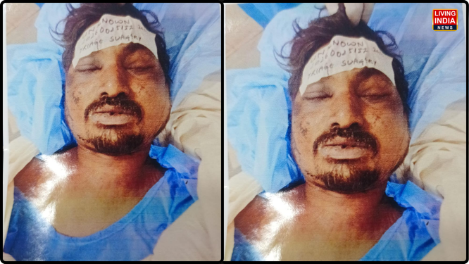 चंडीगढ़ के सेक्टर-28 स्थित एक वाइन शॉप के पास हुए झगड़े में गंभीर रूप से घायल एक अज्ञात व्यक्ति की अस्पताल में इलाज के दौरान मौत हो गई है।
