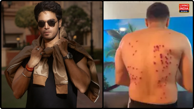 ਮਸ਼ਹੂਰ ਰਿਐਲਿਟੀ ਸ਼ੋਅ Khatron Ke Khiladi 15 ਦੇ ਤਾਜ਼ਾ ਐਪੀਸੋਡ ਤੋਂ ਬਾਅਦ ਪ੍ਰਤੀਯੋਗੀਆਂ (ਕੰਟੈਸਟੈਂਟਸ) ਦੀ ਸੁਰੱਖਿਆ ਨੂੰ ਲੈ ਕੇ ਪ੍ਰਸ਼ੰਸਕਾਂ ਵਿੱਚ ਭਾਰੀ ਚਿੰਤਾ